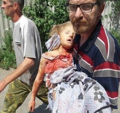 child_wounded_by_kievs_military_attacks_eastern_ukraine_400